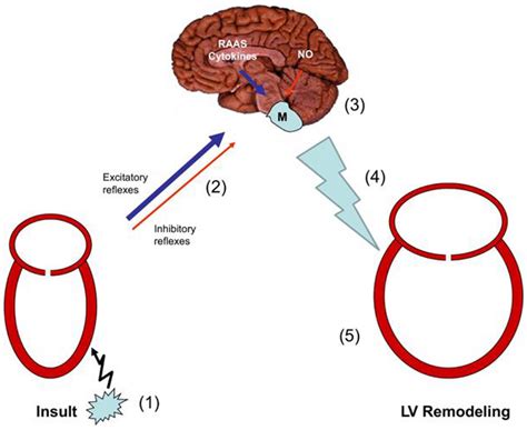 Sympathetic activation in systolic heart failure. An insult causes 